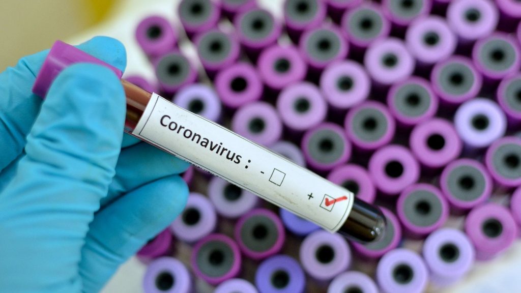 «Пассивная иммунизация» – лекарство от коронавируса